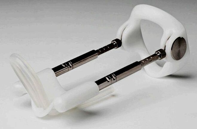 extender for penis enlargement